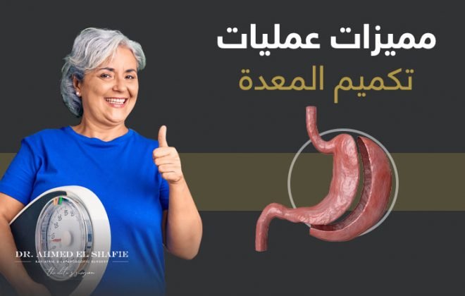 مميزات عملية تكميم المعدة