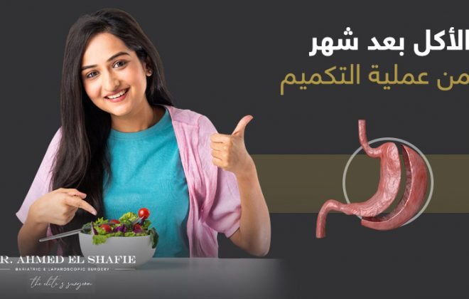 الاكل بعد شهر من عملية التكميم