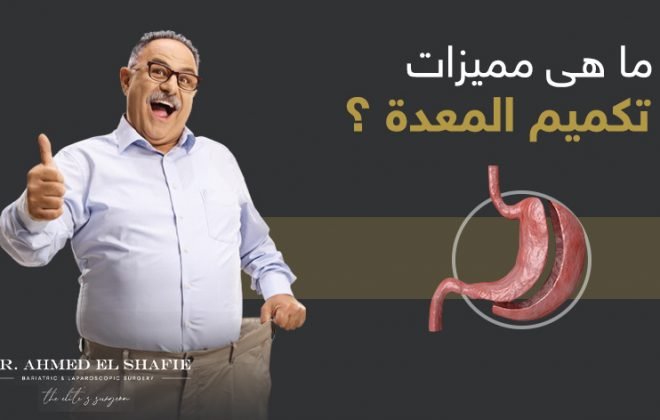 مميزات ونتائج عملية تكميم المعدة